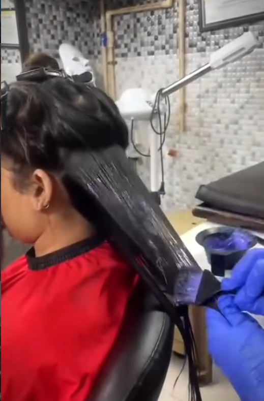 Scalp treatment